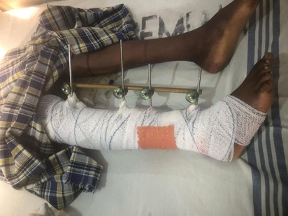 Drifter who allegedly knocked student at Abuko School remanded