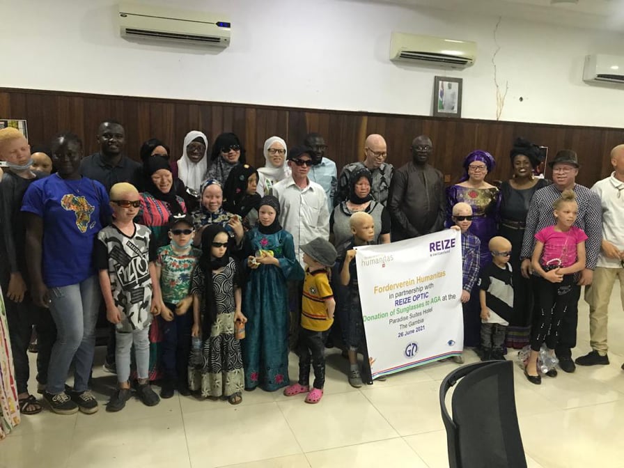 ‘Societal misconceptions led to killings of albinos for spiritual purposes’