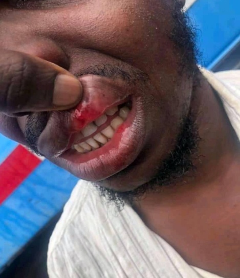 KMC driver allegedly assaulted by ECOMIG Forces