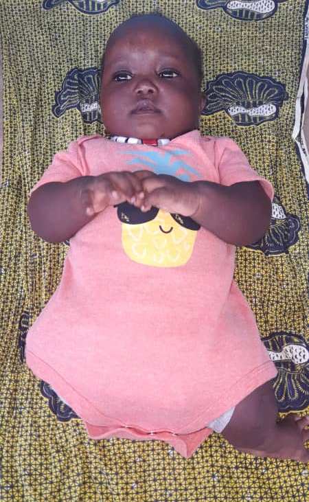 Mother appeals for help for child born with Amelia