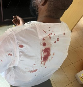 Gambia consul in Angola assaulted by ‘notorious’ thief