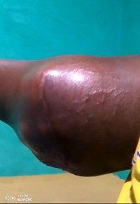 Woman, 27, seeks urgent overseas treatment
