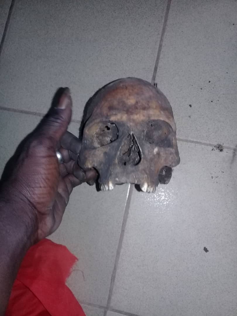 Man arrested with suspected human skull