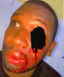 Police deny shooting Sukuta man with rubber bullet