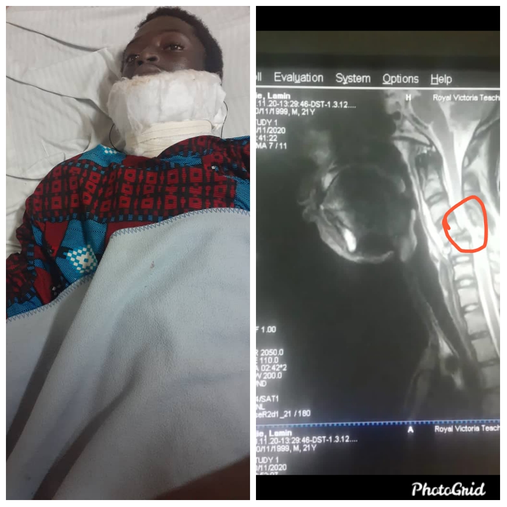 Man, 23, needs urgent overseas treatment