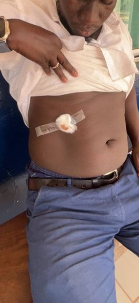 Sanyang resident accuses DLEAG officials of armed robbery