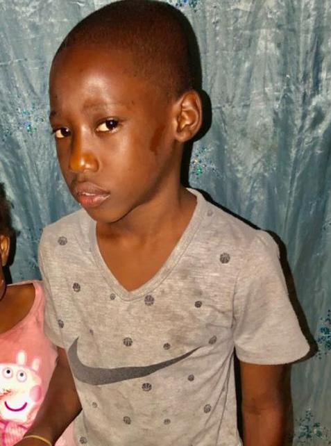 Boy,13, solicits assistance for overseas treatment