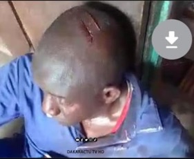 2 confirmed dead following attack on Medina Gounass Calipha’s car
