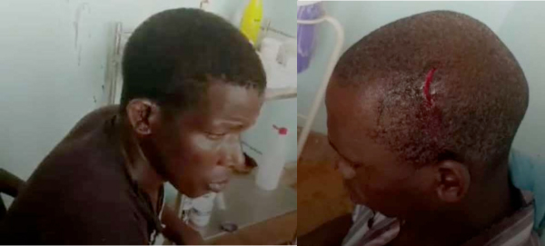 12 wounded, compound set ablaze in URR land tussle