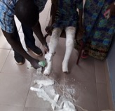 Gambia Clubfoot Foundation treats over 197 children with clubfoot