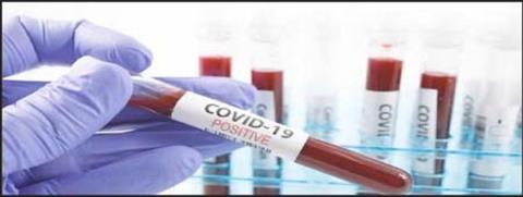 Gambia registers 5 new cases of covid-19