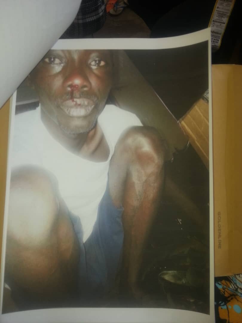 Father and Daughter in need of urgent financial assistance to continue medical treatment