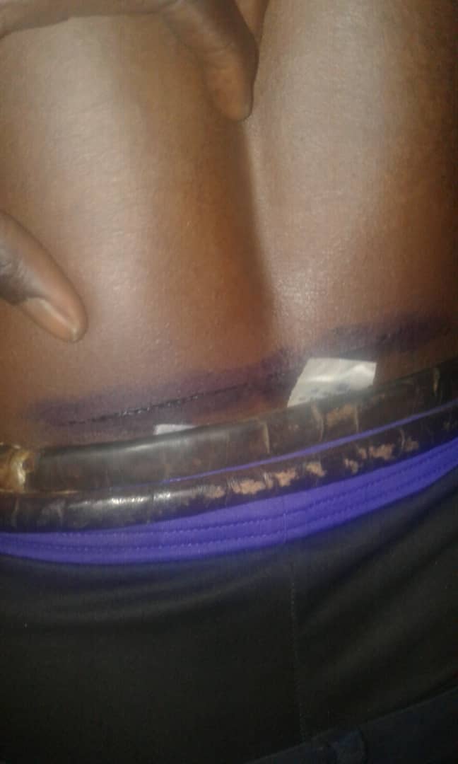 Armed robbers injure PIU officer, escape with over 9m CFA