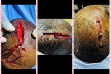 Victim appeals for help after violent assault leaves him unable to work
