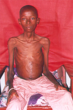 14 Year-Old Boy in Need of Treatment Abroad