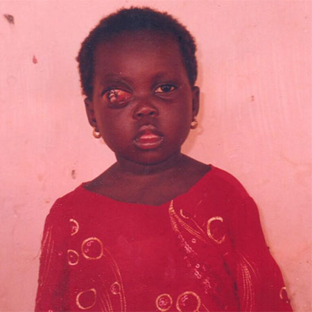 Three Year-Old Girl Needs Overseas Treatment