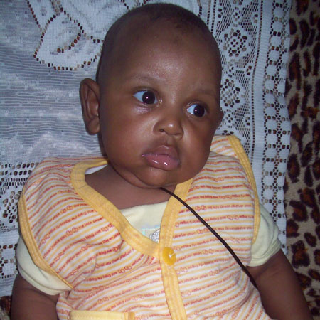 Five Month old Baby Needs Overseas Treatment