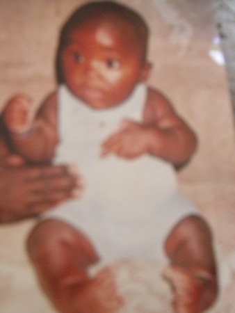 5-month-old baby needs help