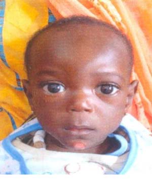 11-month-old baby in need of help