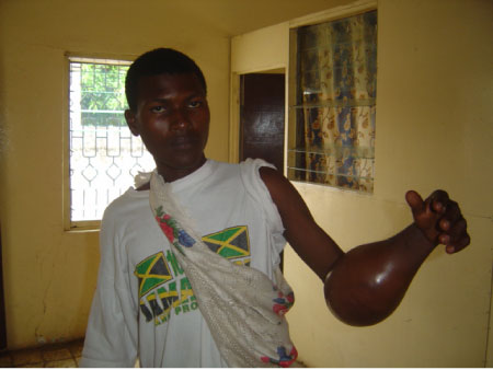 24-year-old seeks support to undergo overseas operation
