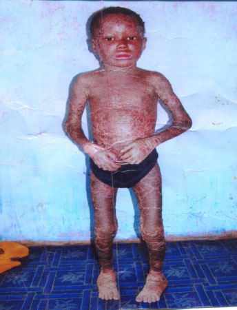 Seven-year-old child seeks medical support