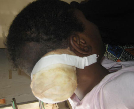 Young girl seeks assistance for overseas treatment