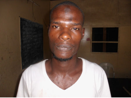 Kidney patient needs treatment support