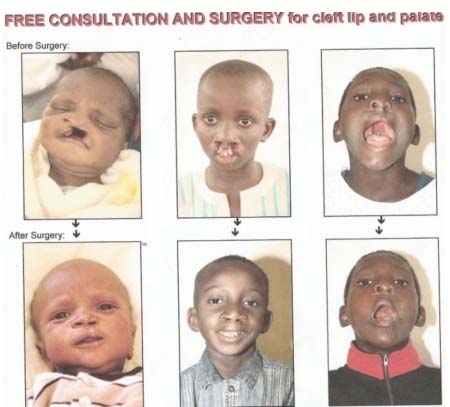 Team of surgeons in town for consultation, ahead of free surgeries 