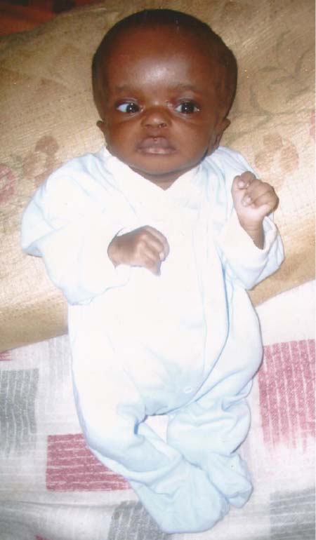 2-month-old baby needs urgent assistance for overseas treatment