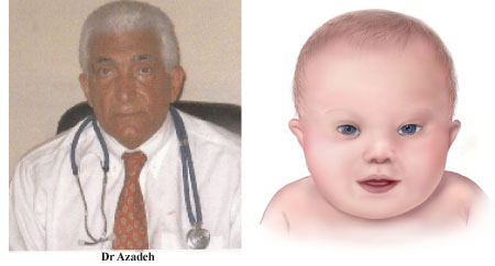 What is the likelihood of having a child with Down Syndrome
