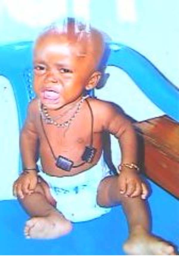 One-year-old boy needs urgent support