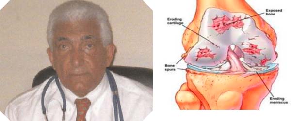 Types of arthritis