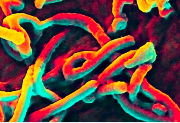Ebola outbreak ‘out of all proportion’ and severity cannot be predicated