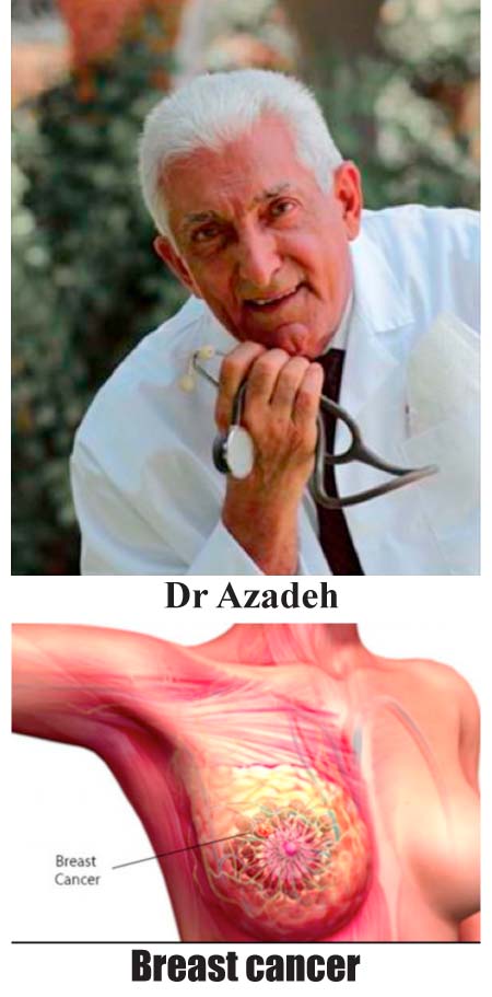 HOME AFFAIRS: Breast cancer, a concern for all