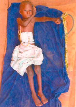 5-year-old boy solicits support to undergo overseas treatment