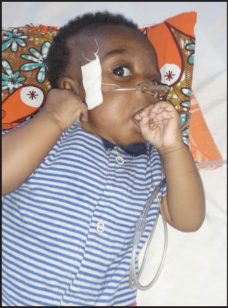 3 months baby needs urgent overseas cardiac surgery